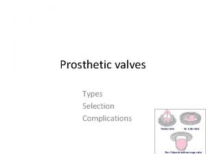 Prosthetic valves Types Selection Complications Types Bioprosthetic valves