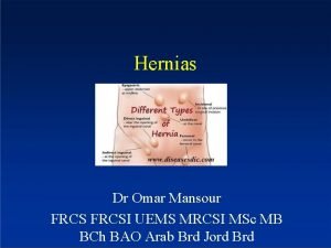 Hernias Dr Omar Mansour FRCSI UEMS MRCSI MSc