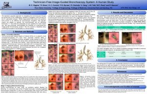 TechnicianFree ImageGuided Bronchoscopy System A Human Study W