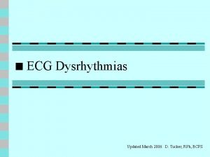 ECG Dysrhythmias Updated March 2006 D Tucker RPh