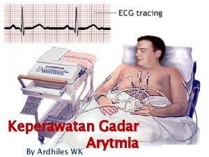 Stemi adalah