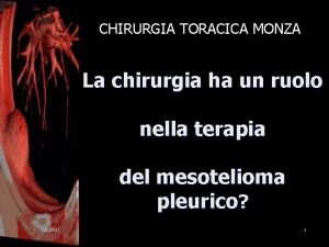 CHIRURGIA TORACICA MONZA La chirurgia ha un ruolo