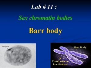 Chromatin body
