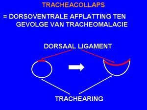 TRACHEACOLLAPS DORSOVENTRALE AFPLATTING TEN GEVOLGE VAN TRACHEOMALACIE DORSAAL