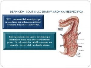 DEFINICIN COLITIS ULCERATIVA CRNICA INESPECFICA CUCI es una