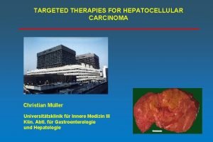 TARGETED THERAPIES FOR HEPATOCELLULAR CARCINOMA Christian Mller Universittsklinik