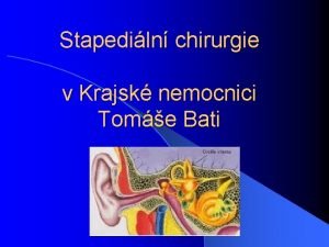 Stapediln chirurgie v Krajsk nemocnici Tome Bati Otosklerza