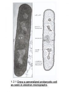 Prokaryotic cell drawing