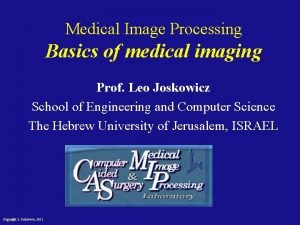 Mri fusion