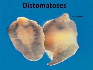 Distomatoses Dr S Ahraou Distomatoses Zoonoses affectent les
