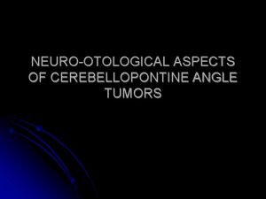 NEUROOTOLOGICAL ASPECTS OF CEREBELLOPONTINE ANGLE TUMORS Anatomy l