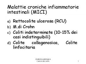 Malattie croniche infiammatorie intestinali MICI Rettocolite ulcerosa RCU