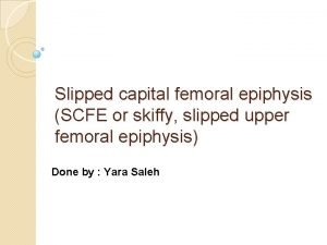 Slipped capital femoral epiphysis SCFE or skiffy slipped