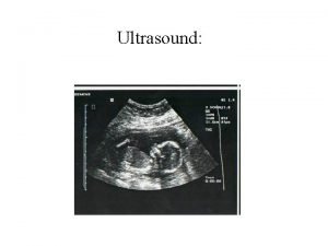 Diagnostic prénatal