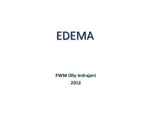 EDEMA PWM Olly Indrajani 2012 Edema Increased fluid
