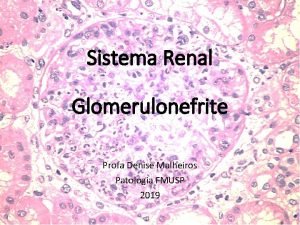 Sistema Renal Glomerulonefrite Profa Denise Malheiros Patologia FMUSP