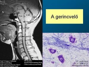 A gerincvel Dr Lukts kos GYOK 2009 04