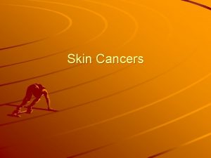 Skin Cancers Skin Layers http www nlm nih
