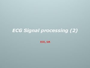 ECG Signal processing 2 ECE UA Content v