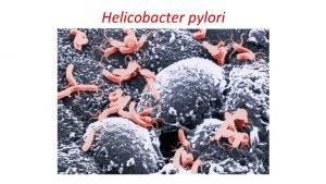 Helicobacter pylori H pylori Caratteristiche generali Batterio Gramnegativo