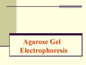 Agarose gel vs polyacrylamide gel