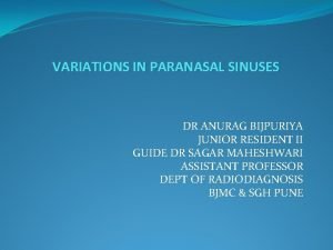 Development of paranasal sinuses
