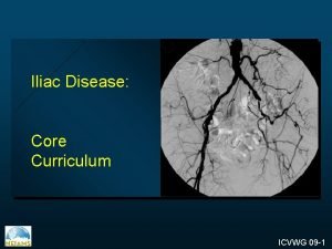 Iliac Disease Core Curriculum ICVWG 09 1 Iliac