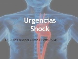 Tipos de shock