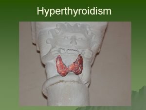 Amiodarone thyroid toxicity