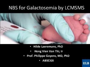 Galactosemia symptoms