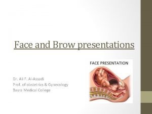 Face and brow presentation
