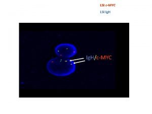 LSI cMYC LSI Ig HcMYC Estudio de clonalidad