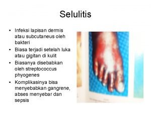 Selulitis Infeksi lapisan dermis atau subcutaneus oleh bakteri