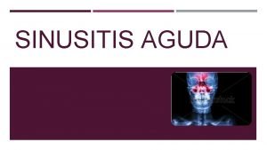 SINUSITIS AGUDA DEFINICIN Inflamacin de la mucosa que