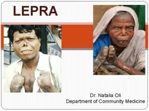 LEPRA Dr Natalia Oli Department of Community Medicine