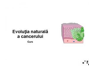 Evoluia natural a cancerului Curs Oncologia ramur a