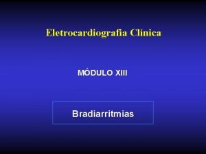 Eletrocardiografia Clnica MDULO XIII Bradiarritmias Bradiarritmias Distrbios da
