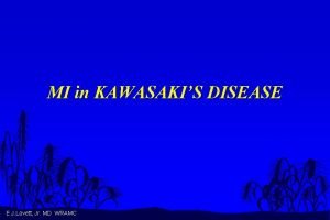 MI in KAWASAKIS DISEASE E J Lovett Jr