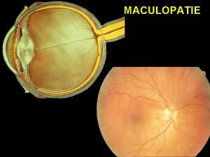 MACULOPATIE Reticolo di Amsler DIAGNOSTICA STRUMENTALE ANGIOGRAFIA RETINICA