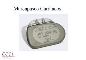 Marcapasos Cardacos Pedro Arzuaga Setiembre 1 Contenido del