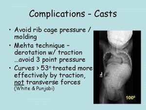 Complications Casts Avoid rib cage pressure molding Mehta