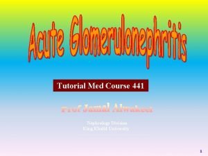 Acute glomerulonephritis causes