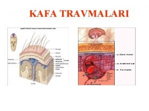 Akselerasyon yaralanması nedir