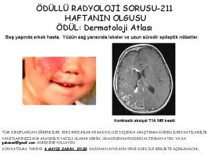 DLL RADYOLOJ SORUSU211 HAFTANIN OLGUSU DL Dermatoloji Atlas