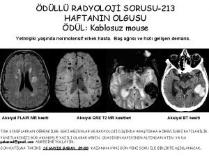 DLL RADYOLOJ SORUSU213 HAFTANIN OLGUSU DL Kablosuz mouse