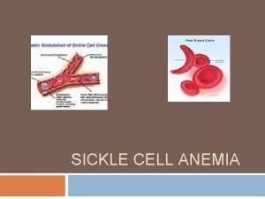 SICKLE CELL ANEMIA Sicklecell disease SCD also known