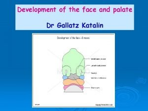Development of the face and palate Dr Gallatz
