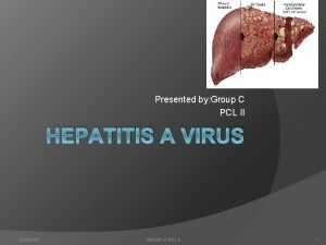 Presented by Group C PCL II HEPATITIS A