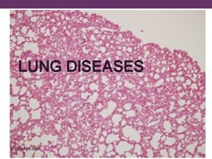 LUNG DISEASES 2016 Paul Billiet ODWS Emphysema aka