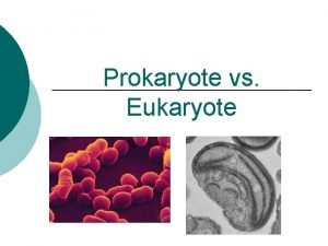 Prokaryote vs Eukaryote What is a Cell Cell